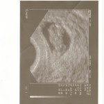 das erste Foto von dir